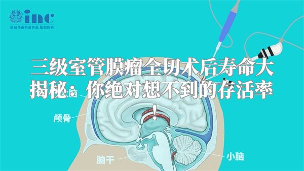 三级室管膜瘤全切术后寿命大揭秘：你绝对想不到的存活率！