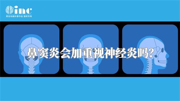鼻窦炎会加重视神经炎吗?
