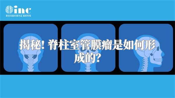揭秘! 脊柱室管膜瘤是如何形成的？