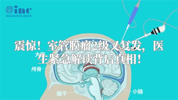 震惊！室管膜瘤2级又复发，医生紧急解读背后真相！