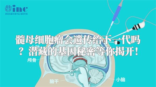髓母细胞瘤会遗传给下一代吗？潜藏的基因秘密等你揭开！
