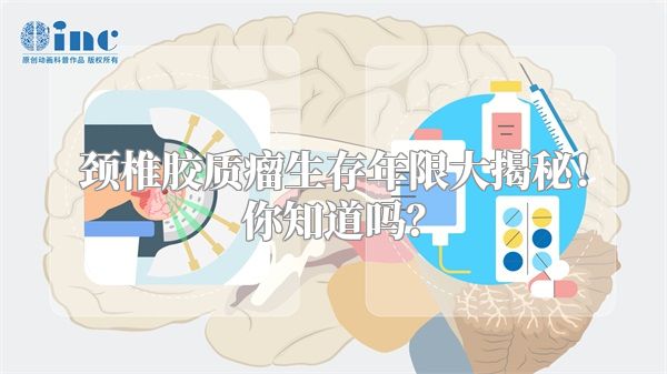 颈椎胶质瘤生存年限大揭秘！你知道吗？