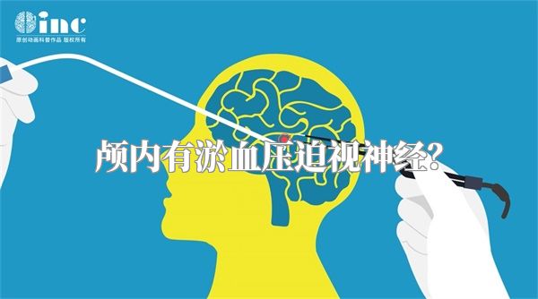 颅内有淤血压迫视神经?