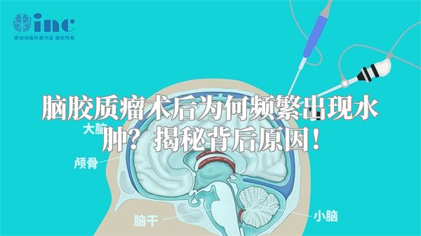 脑胶质瘤术后为何频繁出现水肿？揭秘背后原因！