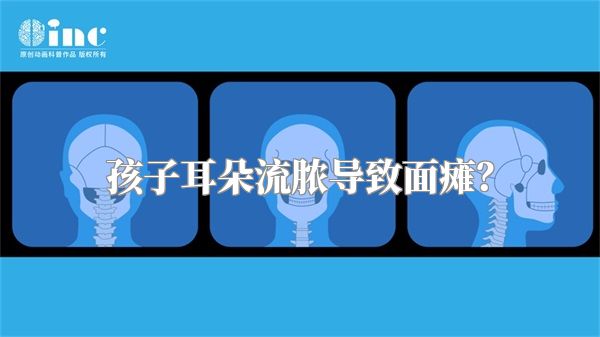 孩子耳朵流脓导致面瘫？