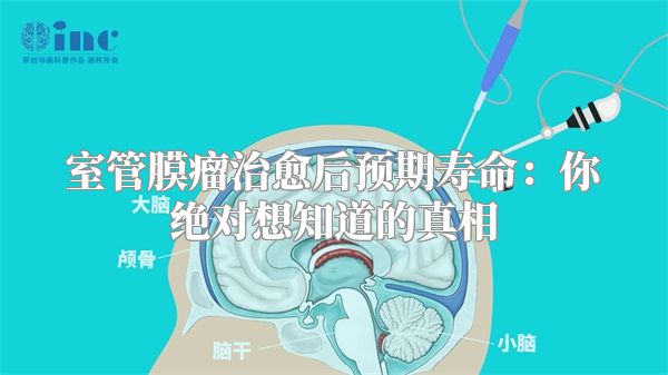 室管膜瘤治愈后预期寿命：你绝对想知道的真相