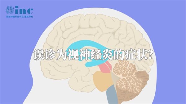 误诊为视神经炎的症状？