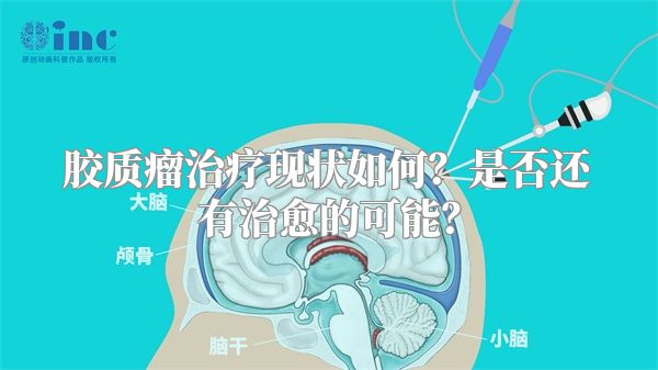 胶质瘤治疗现状如何？是否还有治愈的可能？