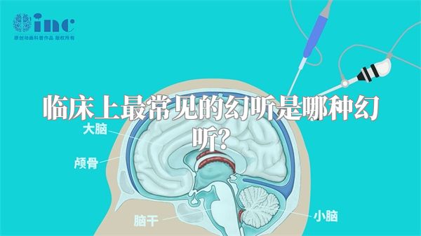 临床上最常见的幻听是哪种幻听？