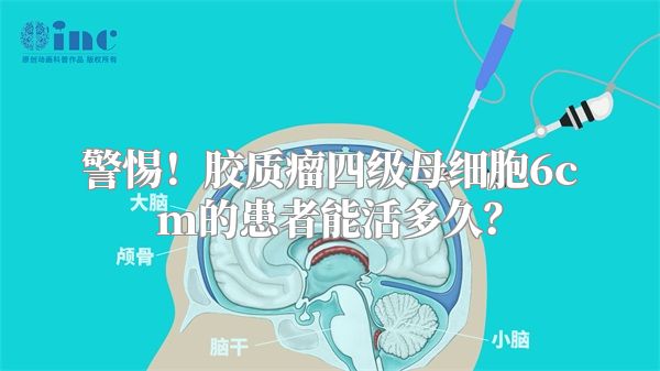 警惕！胶质瘤四级母细胞6cm的患者能活多久？
