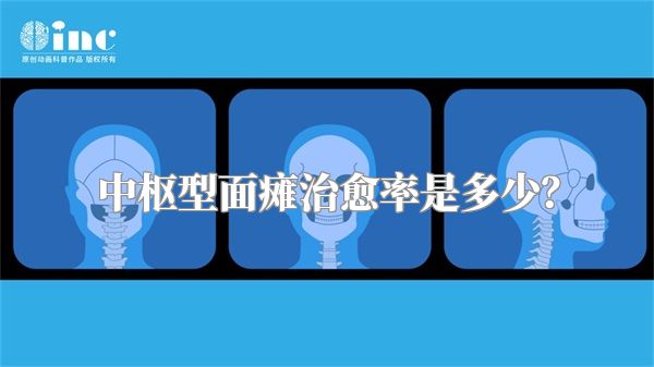 中枢型面瘫治愈率是多少？