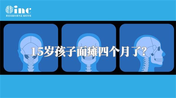 15岁孩子面瘫四个月了？