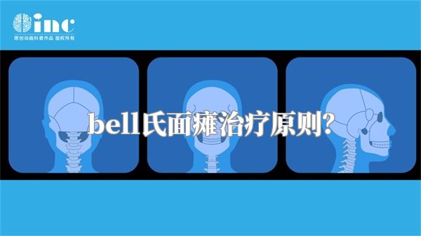 bell氏面瘫治疗原则？