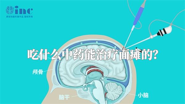 吃什么中药能治疗面瘫的？
