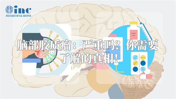 脑部胶质瘤：严重吗？你需要了解的真相！