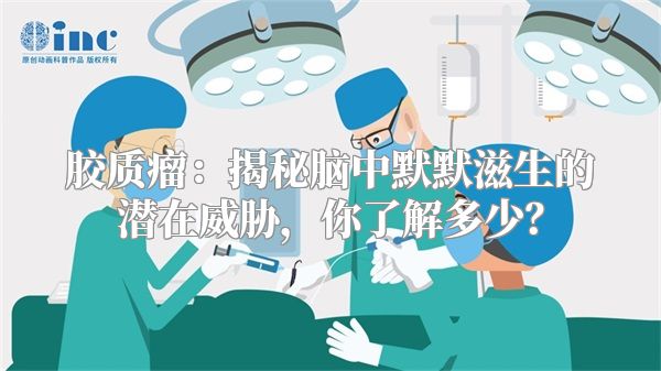 胶质瘤：揭秘脑中默默滋生的潜在威胁，你了解多少？
