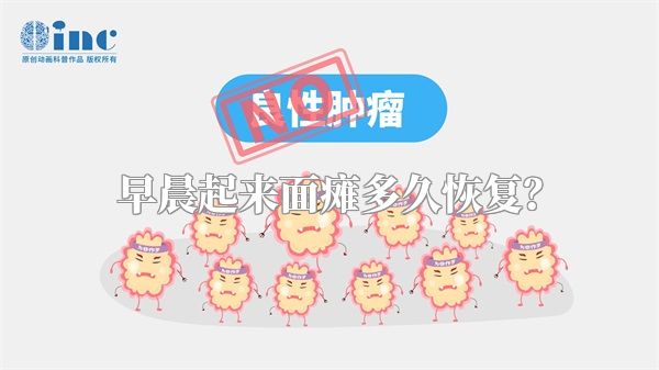 早晨起来面瘫多久恢复？