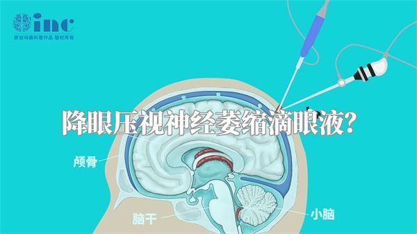 降眼压视神经萎缩滴眼液?