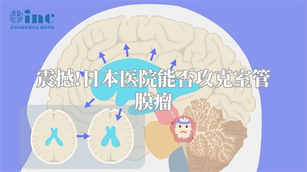 震撼!日本医院能否攻克室管膜瘤
