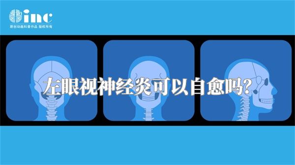 左眼视神经炎可以自愈吗？