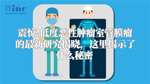 震惊!低度恶性肿瘤室管膜瘤的最新研究揭晓，这里揭示了什么秘密