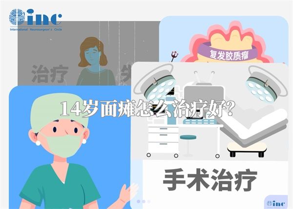 14岁面瘫怎么治疗好？