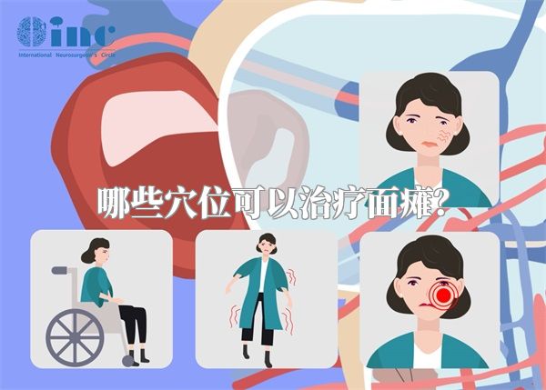 哪些穴位可以治疗面瘫？