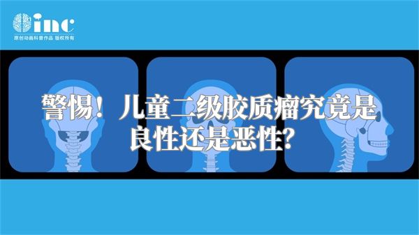 警惕！儿童二级胶质瘤究竟是良性还是恶性？