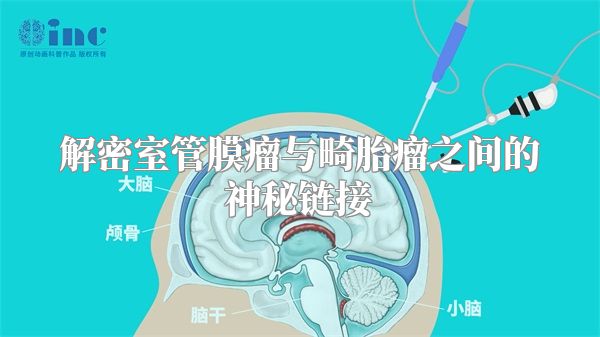 解密室管膜瘤与畸胎瘤之间的神秘链接