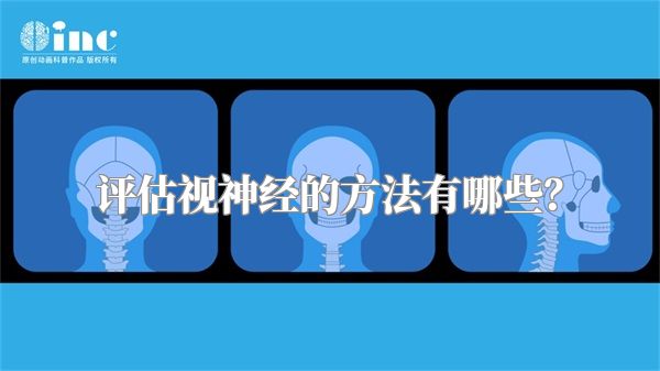 评估视神经的方法有哪些？