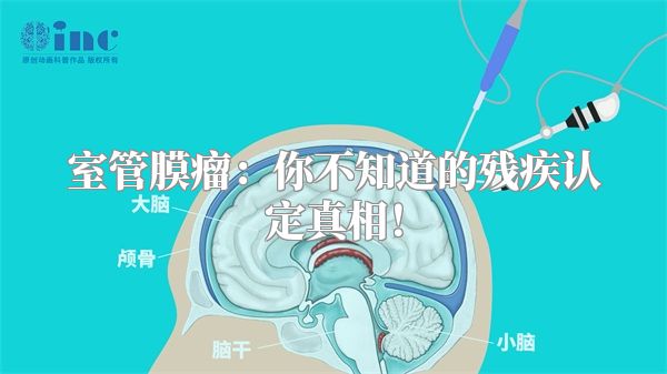 室管膜瘤：你不知道的残疾认定真相！