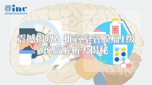 震撼揭晓！椎管室管膜瘤1级预后解析大揭秘