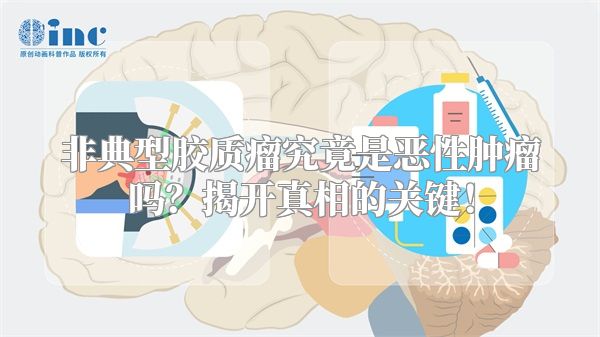 非典型胶质瘤究竟是恶性肿瘤吗？揭开真相的关键！