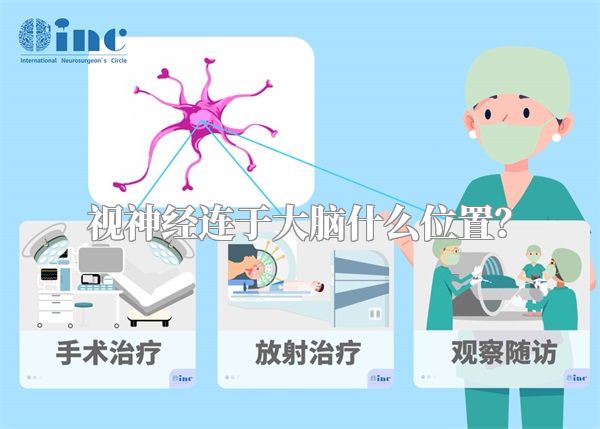 视神经连于大脑什么位置？