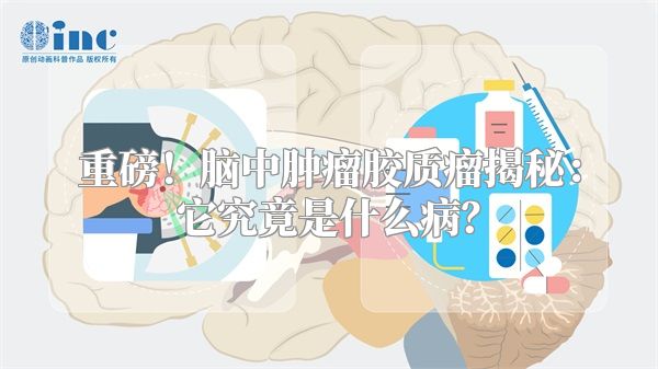 重磅！脑中肿瘤胶质瘤揭秘：它究竟是什么病？