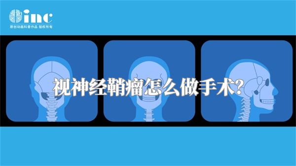 视神经鞘瘤怎么做手术?