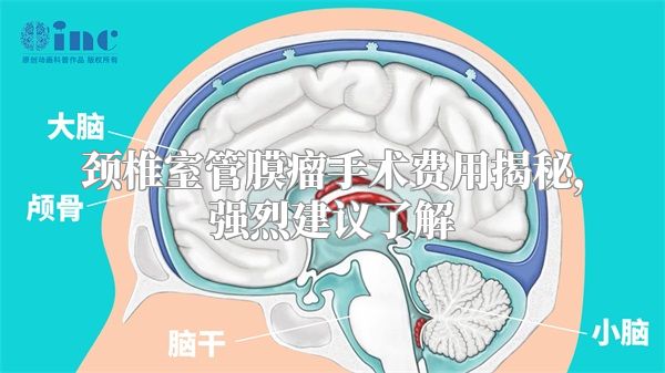 颈椎室管膜瘤手术费用揭秘，强烈建议了解