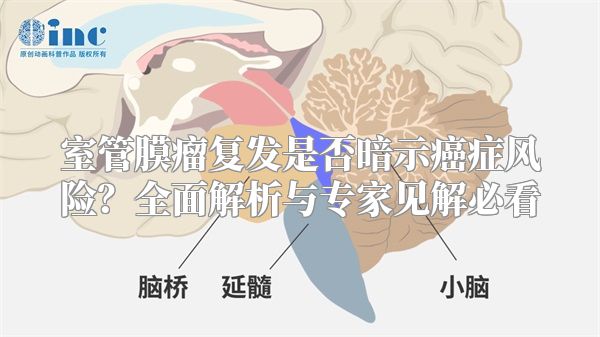室管膜瘤复发是否暗示癌症风险？全面解析与专家见解必看
