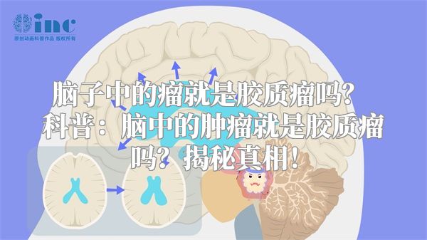 脑子中的瘤就是胶质瘤吗？ 科普：脑中的肿瘤就是胶质瘤吗？揭秘真相！
