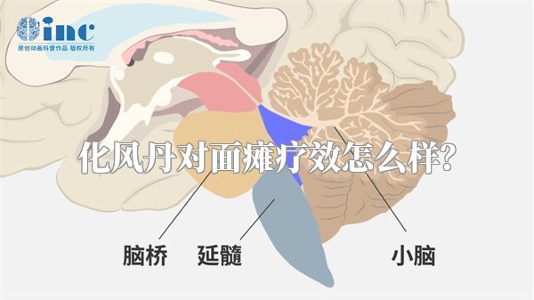 化风丹对面瘫疗效怎么样？