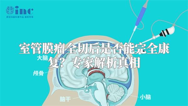 室管膜瘤全切后是否能完全康复？专家解析真相