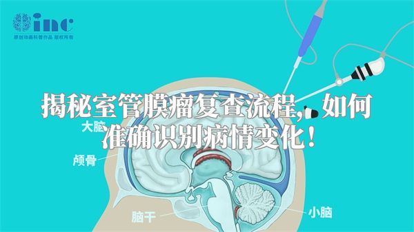 揭秘室管膜瘤复查流程，如何准确识别病情变化！