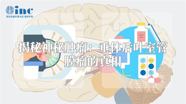 揭秘神秘肿瘤：垂体后叶室管膜瘤的真相