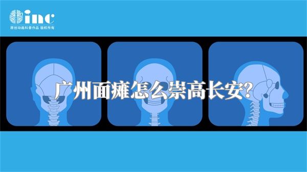 广州面瘫怎么崇高长安？