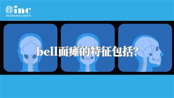 bell面瘫的特征包括？