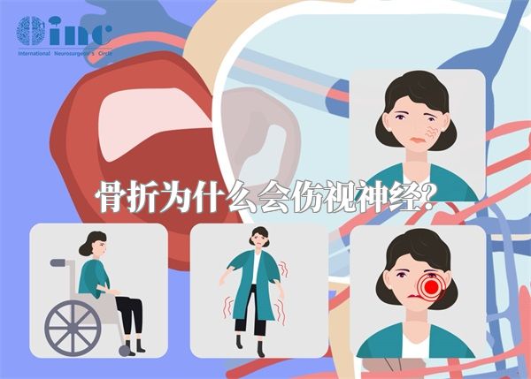骨折为什么会伤视神经？