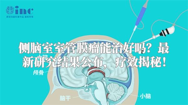 侧脑室室管膜瘤能治好吗？最新研究结果公布，疗效揭秘！