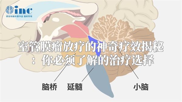 室管膜瘤放疗的神奇疗效揭秘：你必须了解的治疗选择