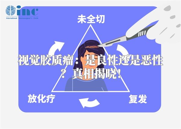 视觉胶质瘤：是良性还是恶性？真相揭晓！