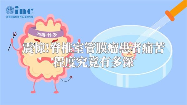 震惊!脊椎室管膜瘤患者痛苦程度究竟有多深